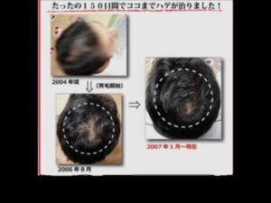 85085-Tmb4kZdXX-M