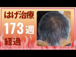 85765-Fr0u8PkPr8g