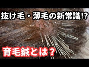 94561-KIMktv1g2Uk