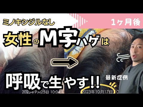 女性のM字ハゲ改善は「呼吸」が大事！！薄毛改善の【呼吸レッスン】