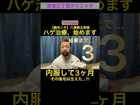 【検証】ミノキシジルって本当に効果あるの？3ヶ月間内服チャレンジ【YouTube切り抜き】