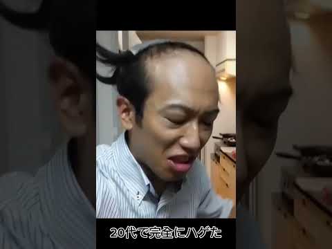 高校生からハゲていた僕がAGA治療で髪が復活#ハゲ #薄毛 #aga