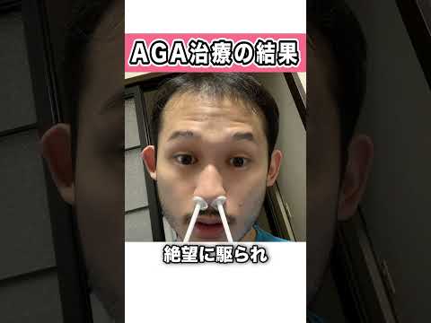 【AGA】薄毛治療で本当に髪は増えるのか？