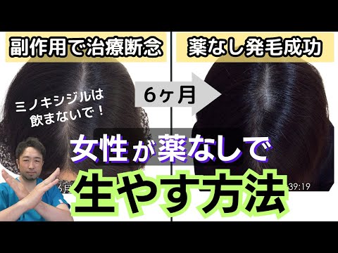 【卒ミノ】女性の薄毛治療薬の闇！ミノキシジル副作用と後悔を実例解説！やめる方法と内服薬なしの女性の薄毛の治し方も解説
