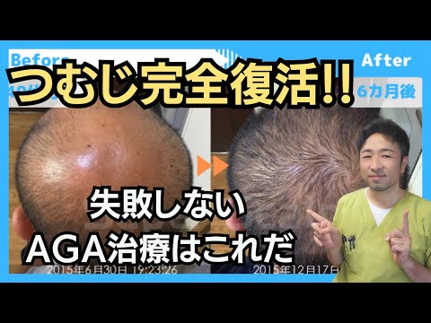 【必見】最も確実な薄毛治療を公開！重度のAGAが半年で改善！薬頼みのAGA治療に足りないものとは？ 個人輸入で効果無い男性必見