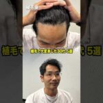 植毛して男前になった30代男性 5選 #shorts