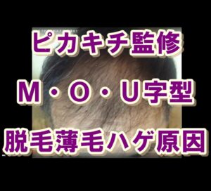 脱毛薄毛ハゲ・育毛解決＃1title3 sq