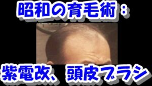 昭和の育毛術：輪ゴム、海藻食べる、育毛剤 紫電改、頭皮ブラシ