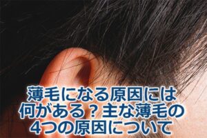 ikumouzai-usuge-gennin