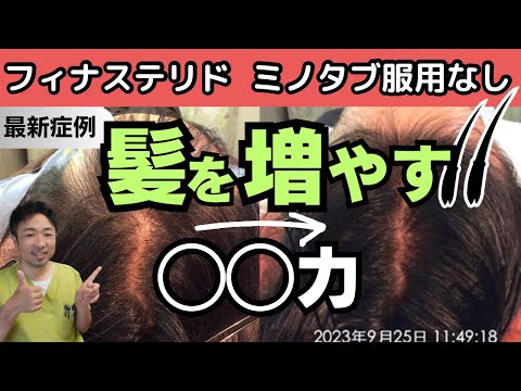 【薄毛改善】飲み薬無しの最新発毛症例。髪を増やす「鍵」は◯◯力を高める事！