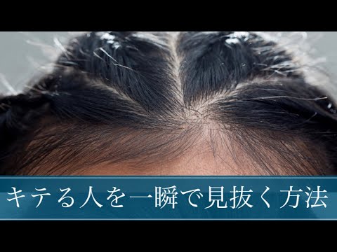 薄毛かどうかを一瞬で見抜く方法